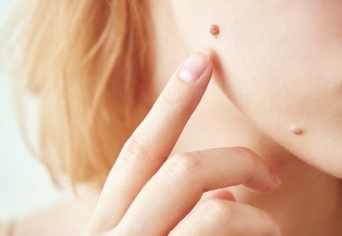 MAKULÁTLAN SZÉPSÉG